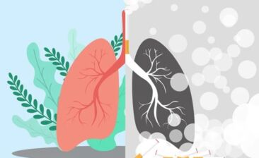 Lung cancer illustration